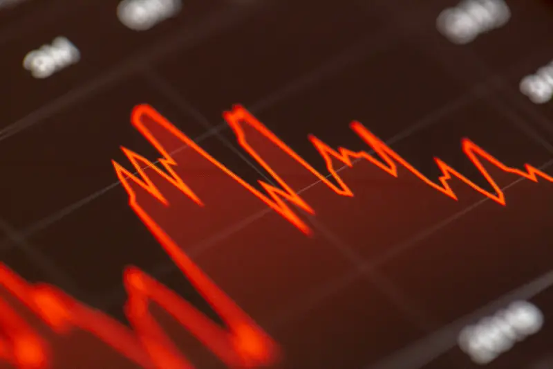 A bank of trading screens showing candlestick price charts.
